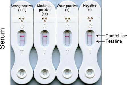 Aspergillus Lateral flow device-assay Yatay akım testi Hasta başı test Aspergillus aktif ürediği dönemde salınan glikoprotein antijene özgül olarak bağlanan JF5 monoklonal antikorunun kullanıldığı