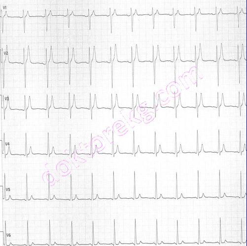 Bu EKG, Dr.