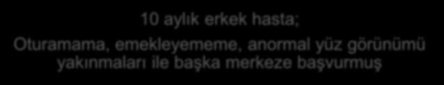 Olgu-1 10 aylık erkek hasta; Oturamama, emekleyememe, anormal yüz görünümü yakınmaları ile başka merkeze