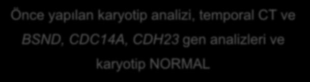 BSND, CDC14A, CDH23 gen analizleri ve karyotip NORMAL