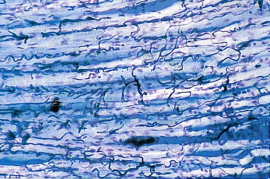 İskelet kas dokusu, oldukça uzun kas hücrelerinden oluşur.