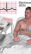 Atriyal% Fibrilasyon% Yönetimi ÖNER 1: AF tanısı koymak için EKG çekilmelidir. (SINIF 1, KD C) * January, CT et al.