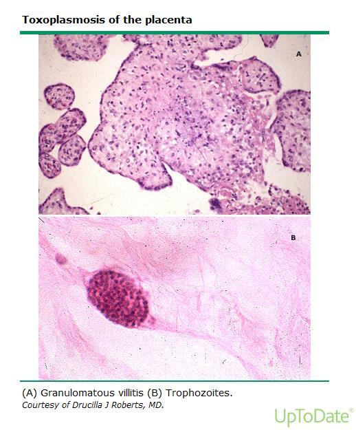 Fetoplasental enfeksiyon hemen maternal enfeksiyondan