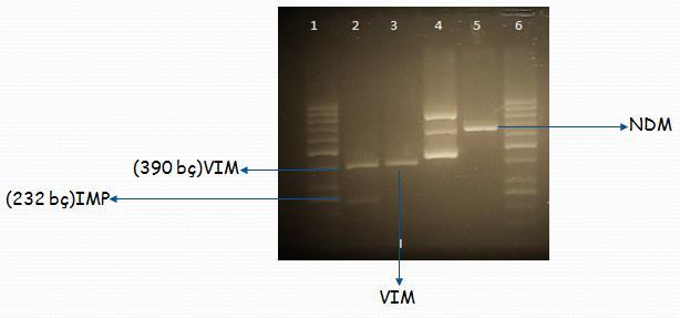 Bulgular ve Tartışma-3 Bir izolat; bla