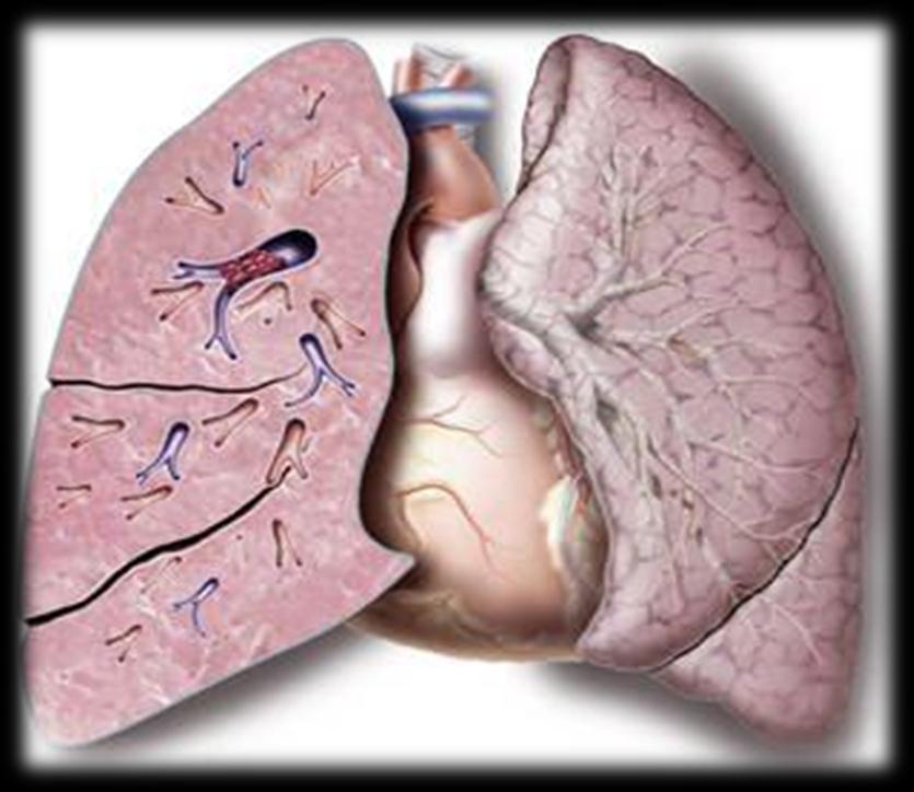 Pulmoner Embolide Yeni Protokollerin