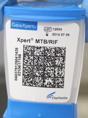 Mediastinoskopi ile LN rezeksiyonu yapıldı. Mikrobiyoloji: ARB pozitif, Xpert MTB/RIF: Mycobacterium tuberculosis complex saptandı.