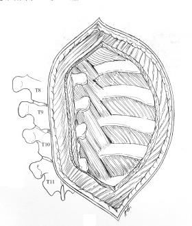 Posterolateral