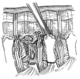 Anterior