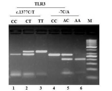 TLR3 c.1377c/t ve TLR3-7A/C polimorfizimleri PCR-RFLP analizi (Polymerase chain reaction based restriction fragment length polymorphism) TLR3 c.