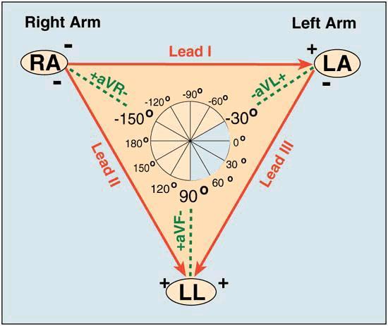 Sağ-sol Sup-inferior Anterior-Posterior Bipolar ekstermite derivasyonlarıı (lead) (frontal plane): Lead I: RA (-) to LA (+) (Right or