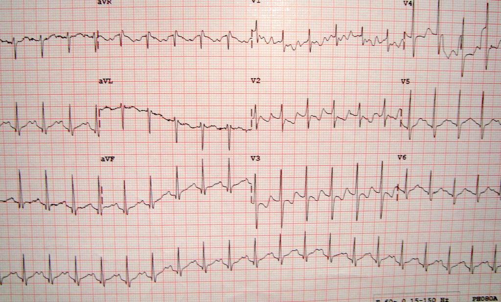 7 yaş, pulmoner