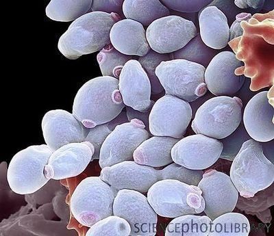 Scanning electron microscope image of