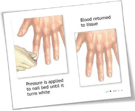 Dolaşım Takibi Kapiller dolum flep alanına parmağın uç kısmıyla yapılan hafif basınç ile değerlendirilir.