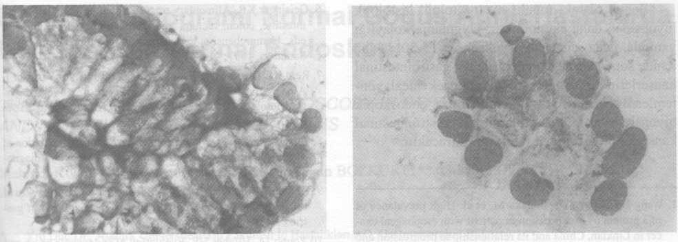 Şekil 2A. Midede normal glandüler epitel hücre topluluğu izlenmektedir (Touch smear sitoloji, May-Grünwald Giemsa, X 1000 orjinal büyütme). Şekil 2B.