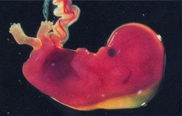 haftalar arası izlem Ultrasonografi ve riskli durumlarda biyofizik profil ve doppler ultrasonografi, NST (haftalık- 40.