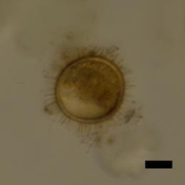 dinoflagellat