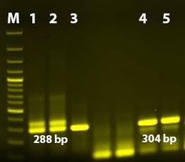 4.2 GENOTİPLENDİRME, SEKANS VE FİLOGENETİK ANALİZLER 4.2.1 SSU-Intergenic Spacer-LSU rrna Geninin Amplifikasyon Sonuçları Tür spesifik SSU rrna analizleri ile E. cuniculli ve E.