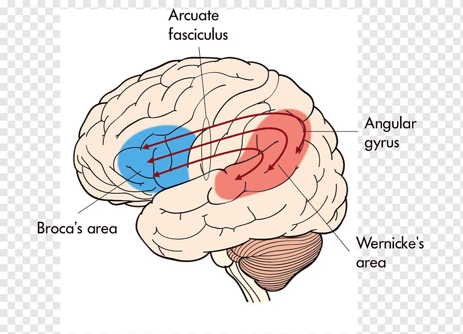 Carl Wernicke 1874 yılında bir nörolog olan Carl Wernicke, Broca nın hastalarından farklı olarak, konuşma yeteneğini tamamen kaybetmemiş fakat karışık, anlaşılamayacak şekilde konuşan, anlamlandırma