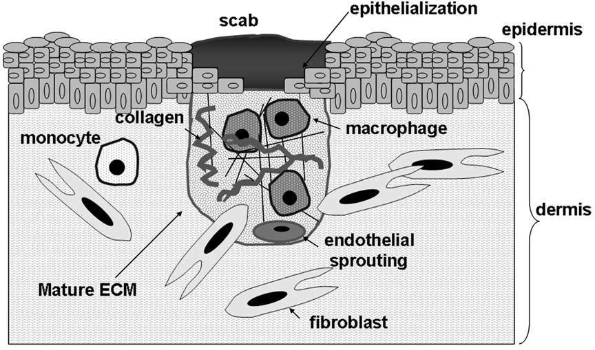 Şekil 1.4. Proliferasyon evresinde, anjiyogenez (endotelyalfilizlenme) ve fibroplazi (fibroblastlarve kolajen) olgun ESM oluşumuna katkıda bulunur. Epitelizasyon meydana gelir.