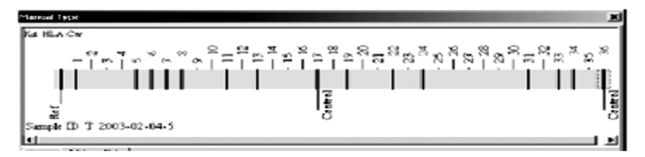 Her reaksiyon tübüne kontrol amacıyla çeşitlilik göstermeyen bir hücresel proteini kodlayan gene özgün primer seti eklenir.