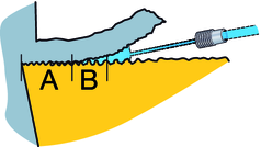 Ana yedek parçalar Kesici uç ölçüsü K i Levye Vida Anahtar (mm) Altlık Ağız (delik çapı mm.) Tapa 12 1/2 174.3-841M 174.3-821 174.1-864 (3.0) 171.31-850M 5691 026-03 (1.