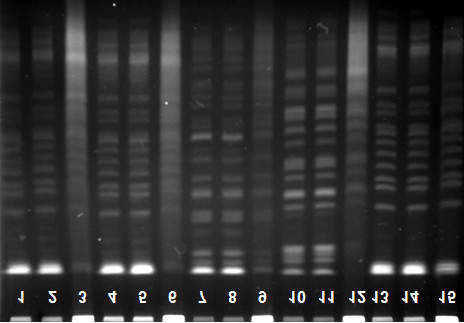 ekil 11.2. K. pneumoniae izolatlar ozonlama öncesi ve sonras PFGE profilleri: 1. grup; Ozonlama yap lmayan, direkt PFGE protokolü uygulanan izolatlar (1, 4, 7, 10, 13). 2.