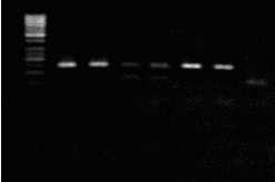 İçermeyen kontrol, M; 50 bç lik DNA Marker ve (14-26) Meme CA hasta DNA ürünleri 4.3.2. G i2α nın 205.