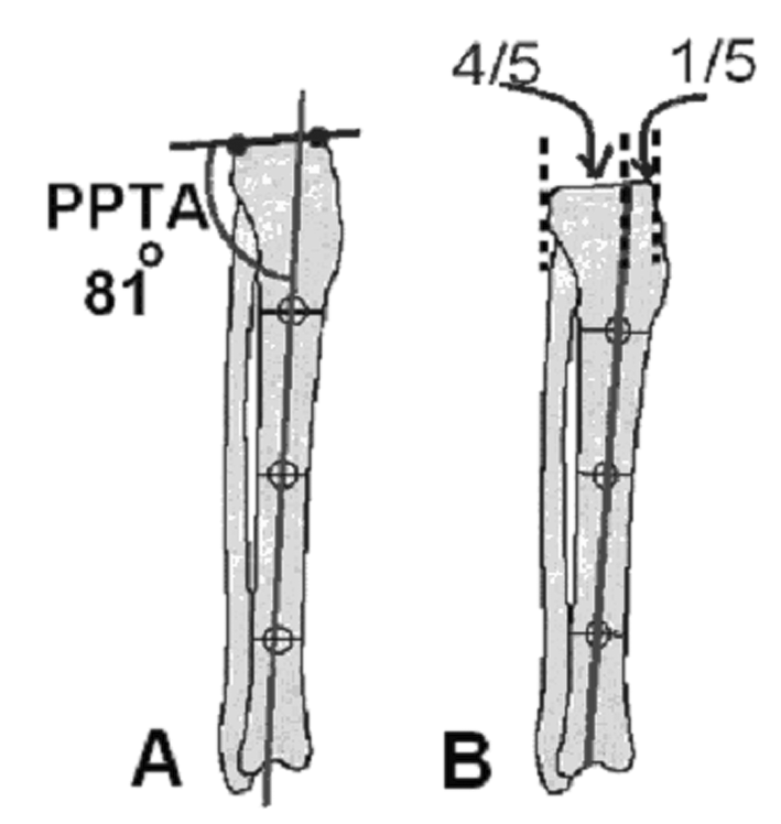 Sagital Plan Malalignment Testi (MAT) Frontal planda malaligment testi yaparken amacýmýz deformite var mý? sorusunun ve varsa yerinin neresi olduðu cevabýnýn bulunmasýdýr.