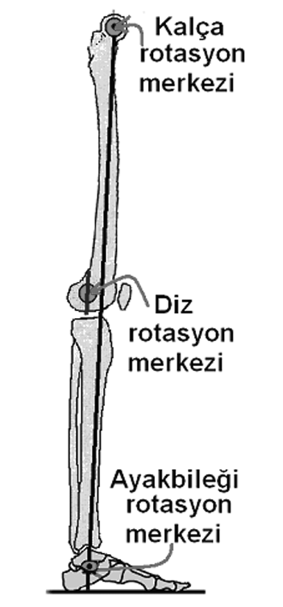 Örneðin fleksiyon dizilim bozukluðu olmayan bir hastada fleksiyon pozisyonunda çekilen radyografide fleksiyon dizilim bozukluðu olduðu sanýlabilir.