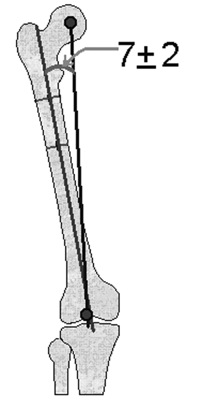 Tibia Anatomik Ekseni Tibianýn diafizine 2 veya 3 yerde dikey olarak çizilen çizgilerin orta noktalarý bulunur. Bu noktalar birleþtirilerek tibianýn anatomik ekseni çizilir (Þekil 10b).