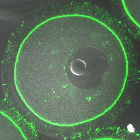 KONFOKAL MİKROSKOBU Fluoresan mikroskobun bir gelişmiş modelidir.