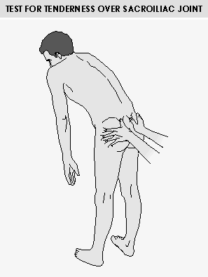 Faber Mennel Bel omurgalarının hareket kısıtlılığı; belin yan fleksiyonları, hiperekstansiyonu, öne fleksiyonu ve aksiyel rotasyonunun yaptırılması ile