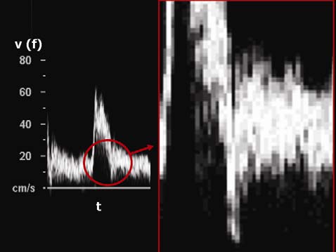 DOPPLER İN UYGUN KULLANIMI 13