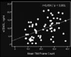 having ectasia in any of the coronary arteries together ith critical stenosis at least one coronary artery segment Plasma and PA- levels ere measured in all patients Additionally demographic and