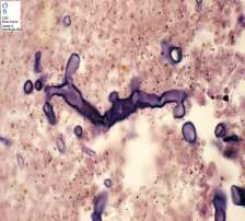 Şekil 13-16. Aspergillus türlerinin mikroskopik görünümleri (www.atsu.edu) Zygomycetes Doğada yaygın olarak bulunan küf mantarlarıdır, oluşturdukları enfeksiyonlara zigomikoz denir.