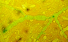Direkt mikroskopik inceleme Zygomycetes lerin Laboratuvar Tanısı İncelenecek örneklerden (paranazal sinus direnajı, akciğer biyopsisi, bronşiyal lavaj, balgam vb.