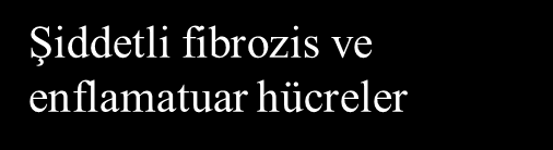 Tip 1 Pnömosit hasarı