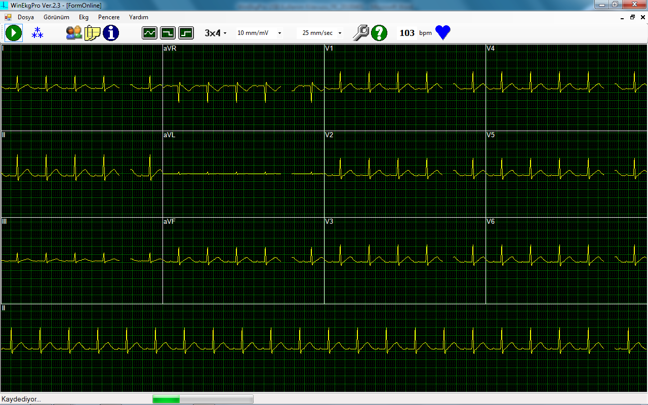 Şekil 5.3. EKG Transfer ve Kayıt Penceresi Kablo bağlantılarınız tamam ve elektrotlar da hastaya takılı ise EKG sinyallerini izlemeye ve kaydetmeye başlayabilirsiniz.