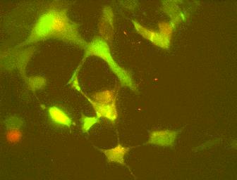 GT1-7 Nöronları: Effects of subtype-specific