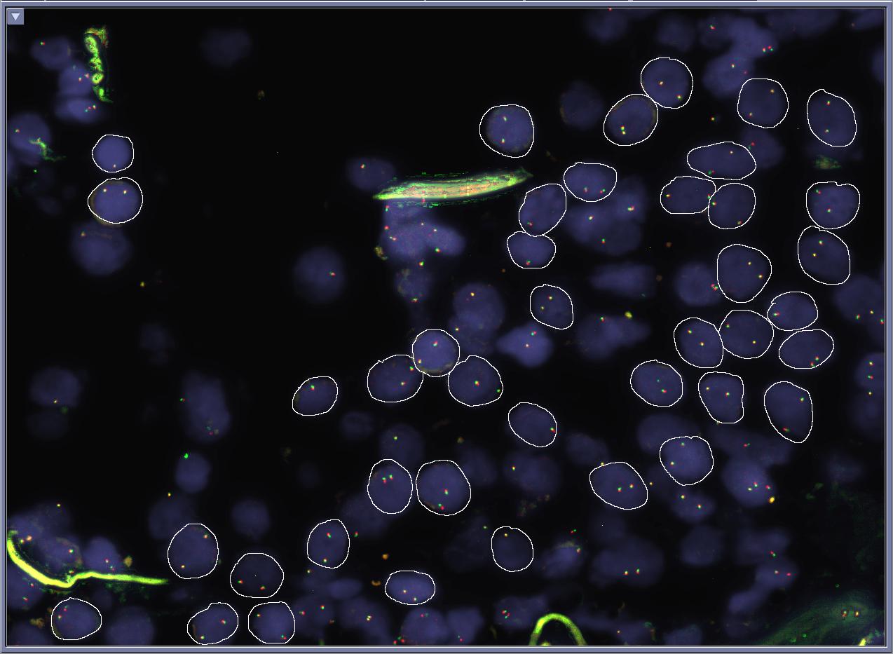 Review and Analysis - Cell Selection Operator selects 50 cells from captured fields Operator selects