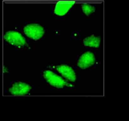 NÜKLEUS Sentriol Midbody Spindle (İğcik şekilli fibril) NuMA-1 CENP-F /p330d Heat shock protein glycolytic spesifik enolas (48 kda, gg isoform), PCM-1 (228 kda), Pericentrin (220 kda) MSA-2