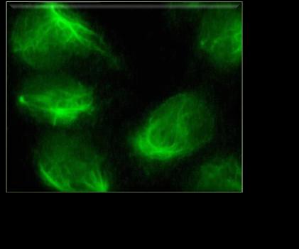 SİTOPLAZMA ince benek büyük benek kaba benek, ipliksi (AMA) Aminoaçil t RNA