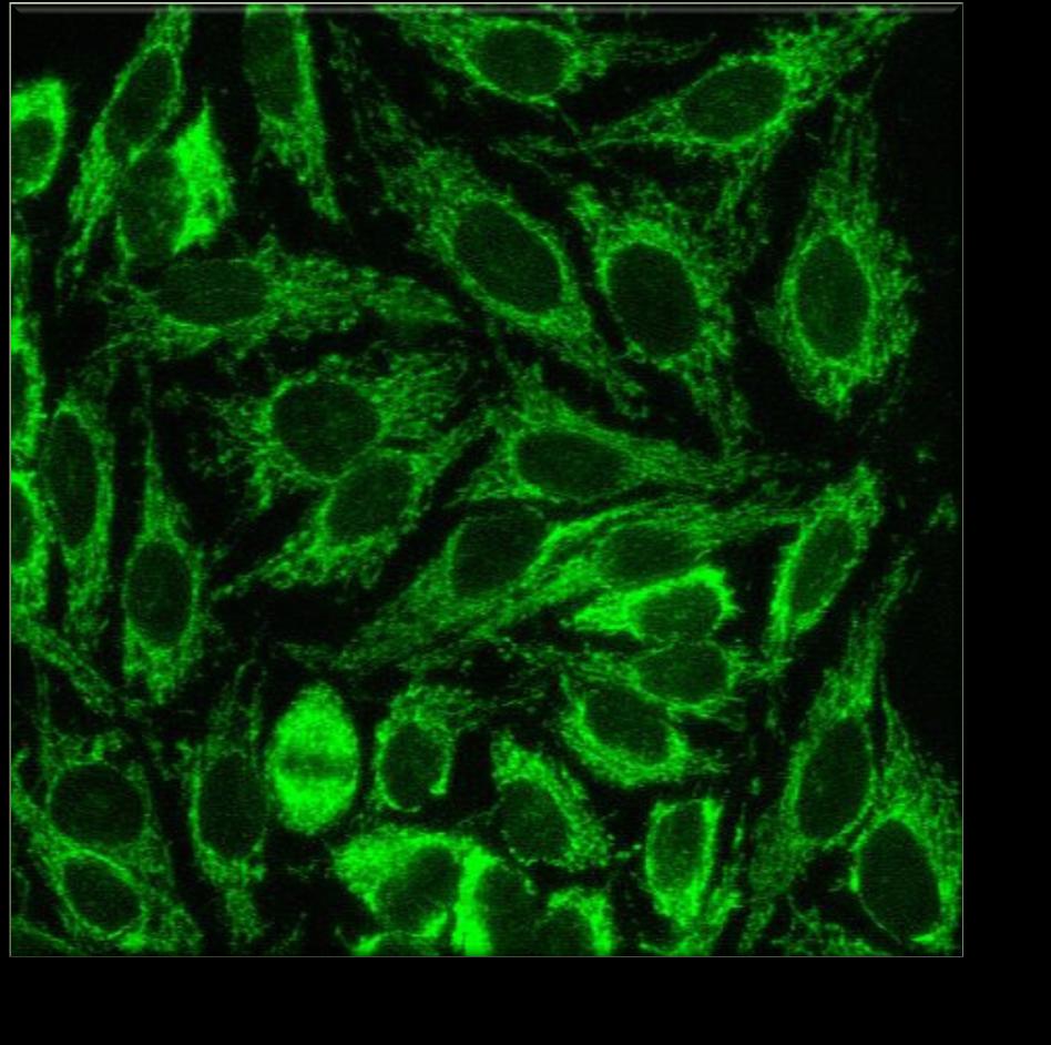 Mitokondriye karşı antikorlar Hep-2 hücre