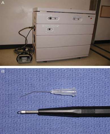 Nd:YAG LASER [Surgical Laser Technologies (SLT) Inc, Malvern, PA] (A) ve safir prob ucu (B) Prob limbustan 1-2 mm geride Başlangıç: 7W ve 0.