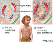 tr 2 Türkiye de ki diyabetli sayı sı yaklaşı k 6 milyon kişi (kaynak:tbmm) Aç karınla glikoz testi (8 saat): norm değe r > 70 ve <100 mg/dl diyabette açlı k glikozu >125 mg/dl = diyabet Rastgelekan