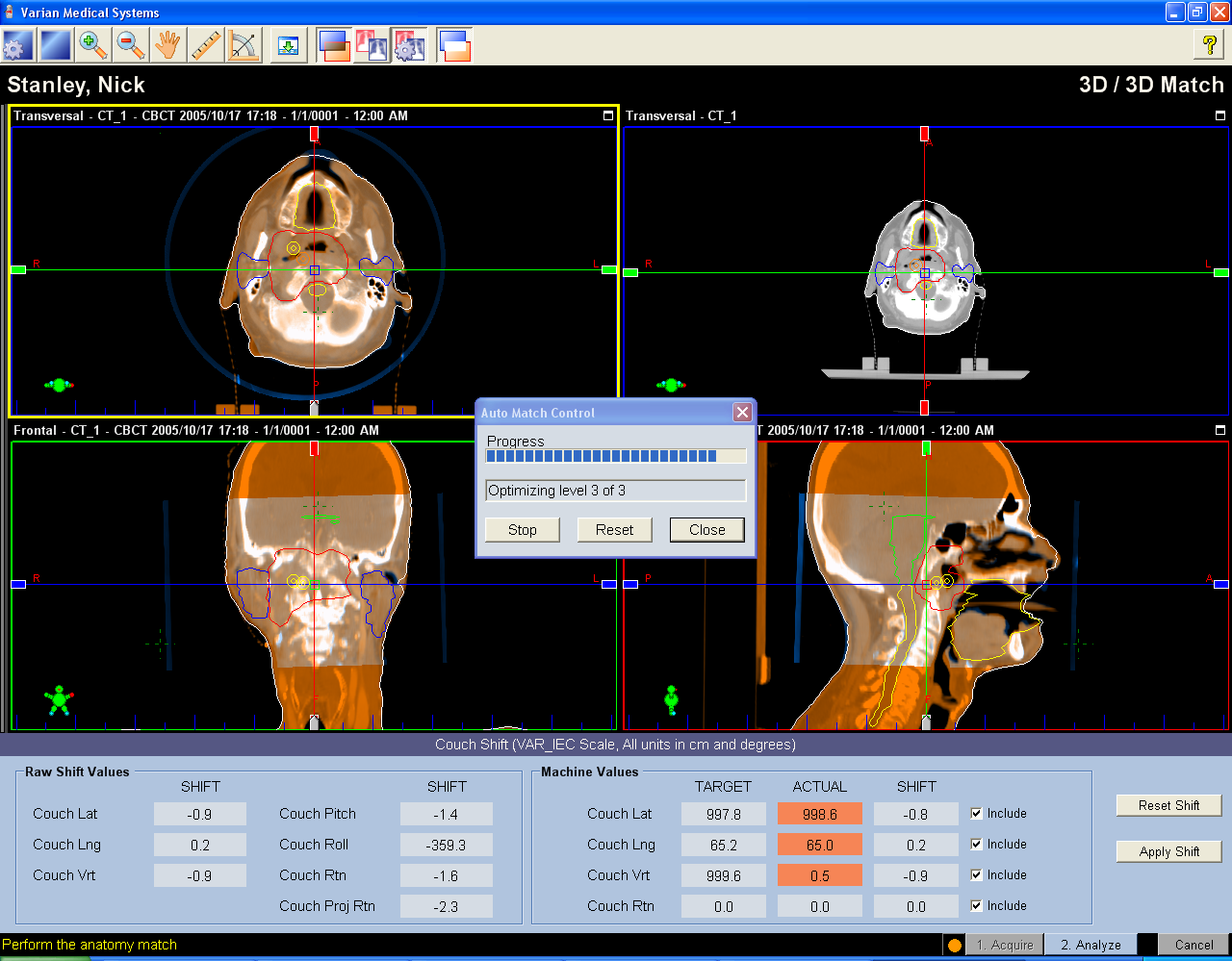 CT CBCT