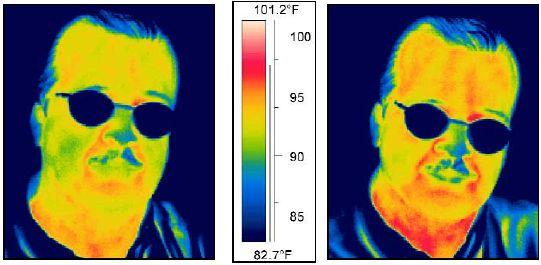 2.4.7. Yüz Termogramı Yüzün ısı haritasının analizi yapılarak kimlik tespiti ve doğrulama işlemlerinde kullanılan biyometrik yöntemlerden biridir.