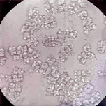 Micrococcus luteus; toprak, su, insan ve hayvan derisinde ya)ar patojen deildirler. Diplococcus: Diplococcus pinamonie zatüre hastalnn bakterisidir.