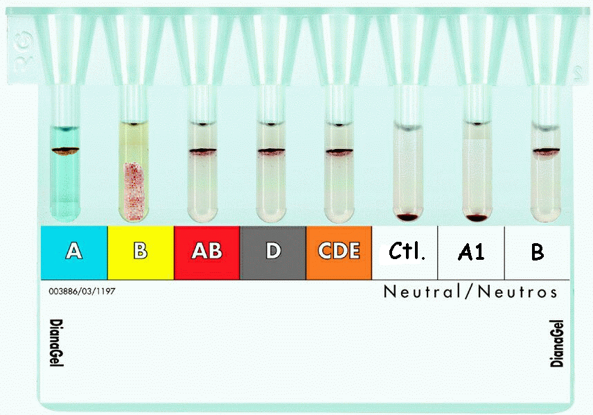 Test Sonuçları ve Değerlendirilmesi Test sonuçları ve bulgular ayrı ayrı kaydedilmelidir Örneğin: Kan gruplama