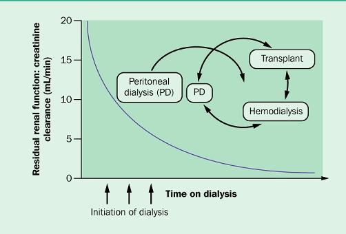 Transplantasyon PD yetersiz